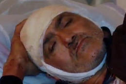 Ötmək istəyirdim, maşınıma girdi” - 6 nəfərin yaralandığı dəhşətli qəzanın GÖRÜNTÜLƏRİ -  VİDEO 